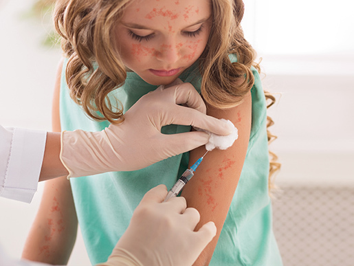 Measles Update